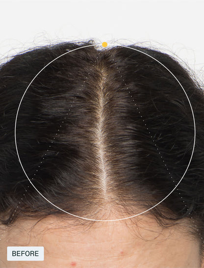 Nutrafol  Women's Vegan Hair Nutraceuticals Supplement 120 Capsule